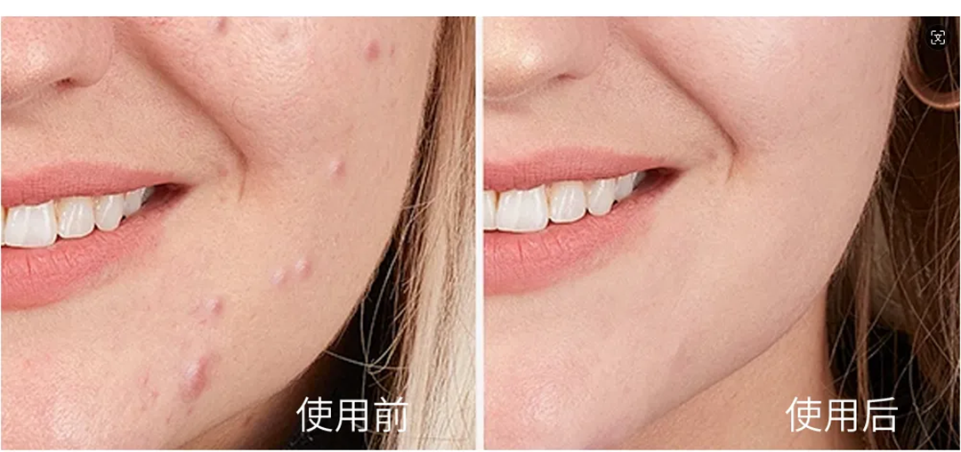 超燃現(xiàn)場(chǎng)｜康容智造火爆點(diǎn)燃儀美尚現(xiàn)場(chǎng)，好次拋·康容造！
