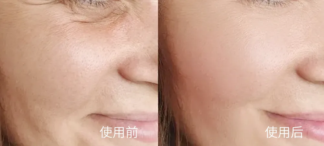 超燃現(xiàn)場(chǎng)｜康容智造火爆點(diǎn)燃儀美尚現(xiàn)場(chǎng)，好次拋·康容造！