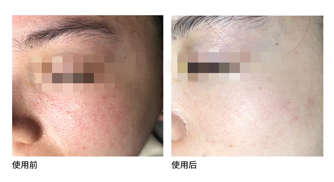 康容科研成果「富養(yǎng)油」·亮相IFSCC國際化妝品權(quán)威大會(huì)·傳遞綠色科技護(hù)膚理念